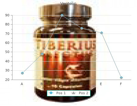 order ventolin 4mg on line