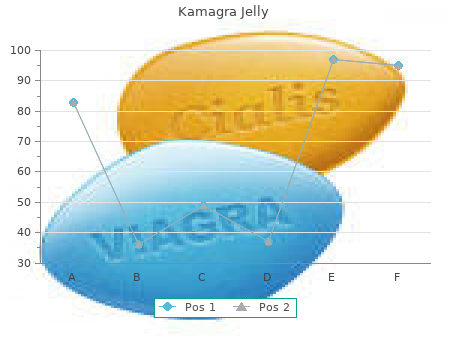 buy 100 mg kamagra jelly mastercard