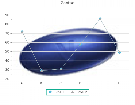 cheap zantac 300 mg online