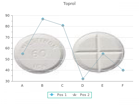 buy toprol 100mg on-line